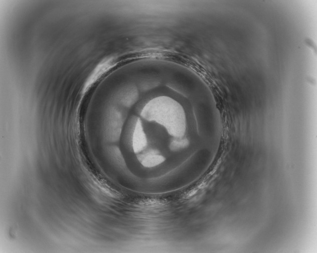 X0000099380198200805081453