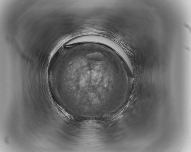 X0000099380244200805081452