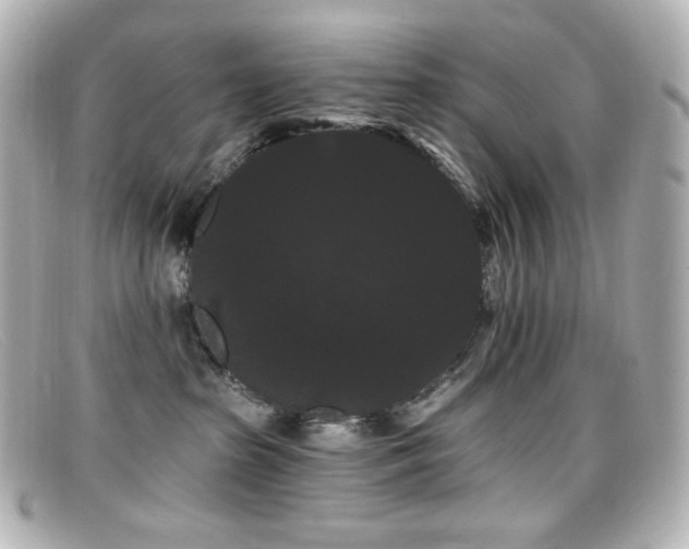 X0000099380285200805081452