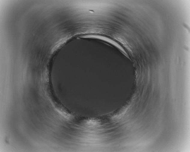 X0000099380303200805081452