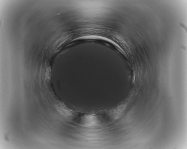 X0000099380325200805081451