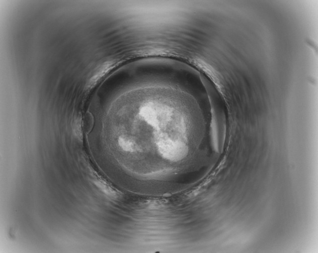 X0000099380345200805081451