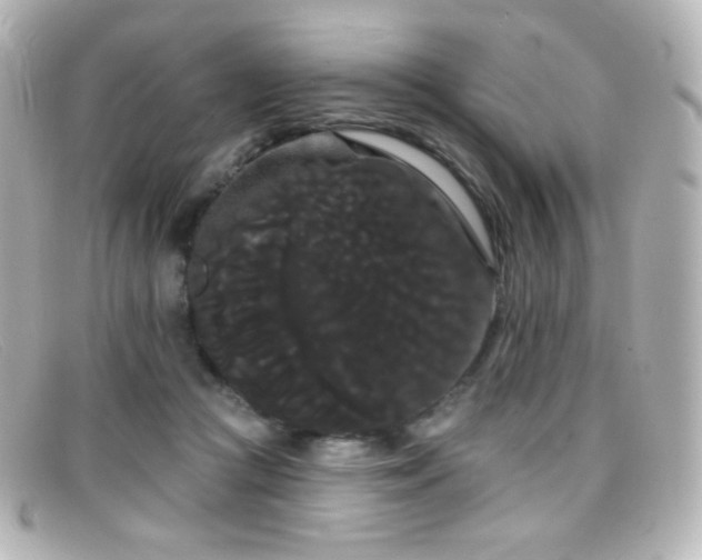 X0000099380361200805081451