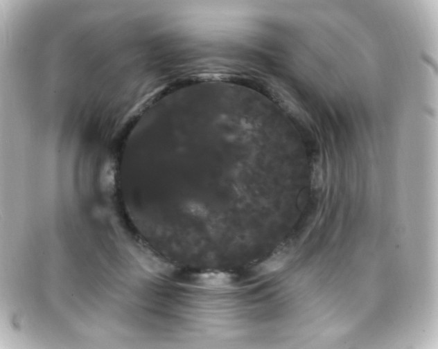 X0000099380363200805081451