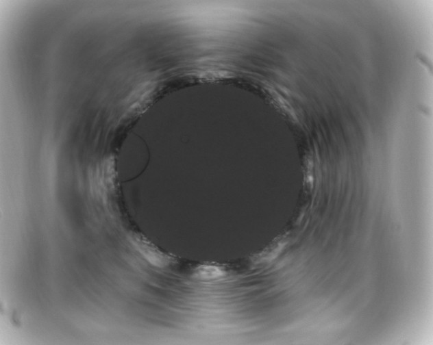 X0000099380519200805081449