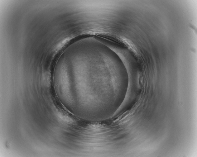 X0000099380540200805081448