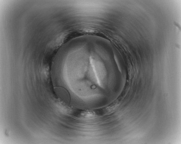 X0000099380559200805081448