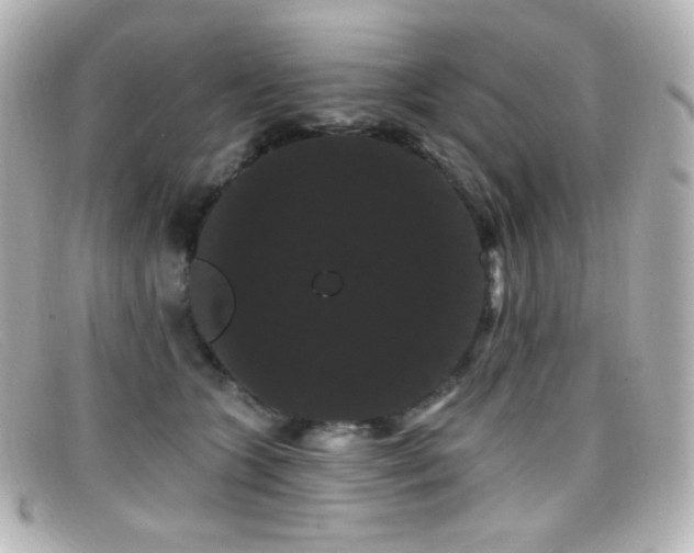 X0000099380563200805081448