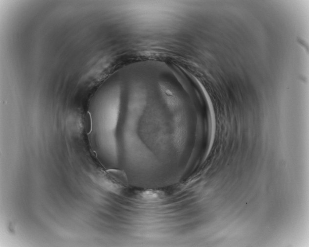 X0000099380566200805081448