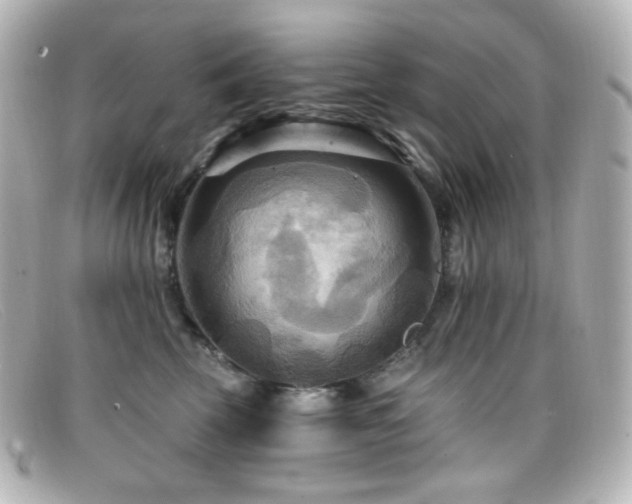 X0000099380569200805081448