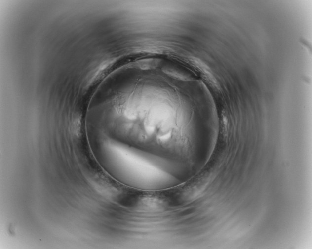 X0000099380596200805081448