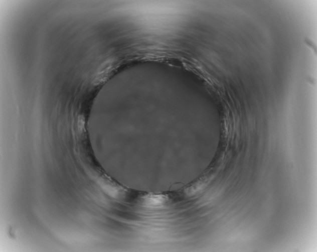 X0000099380711200805081446