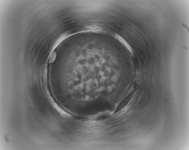 X0000099381099200805081440