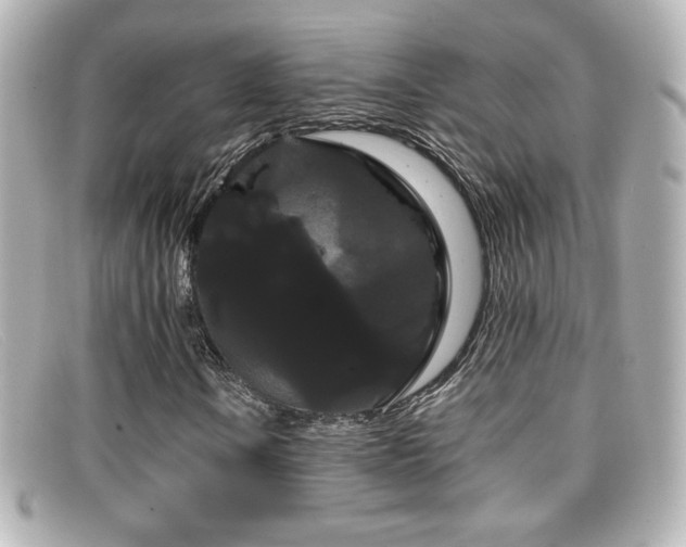 X0000099381106200805081439