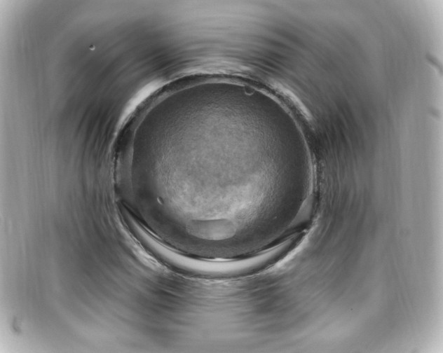 X0000099381114200805081440