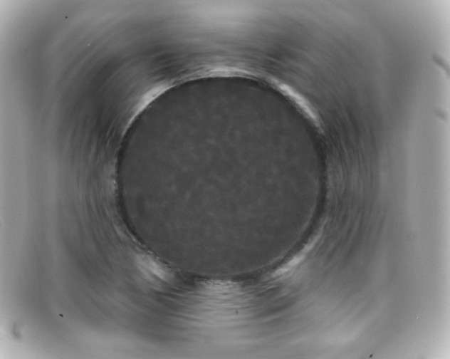 X0000099381170200805081439