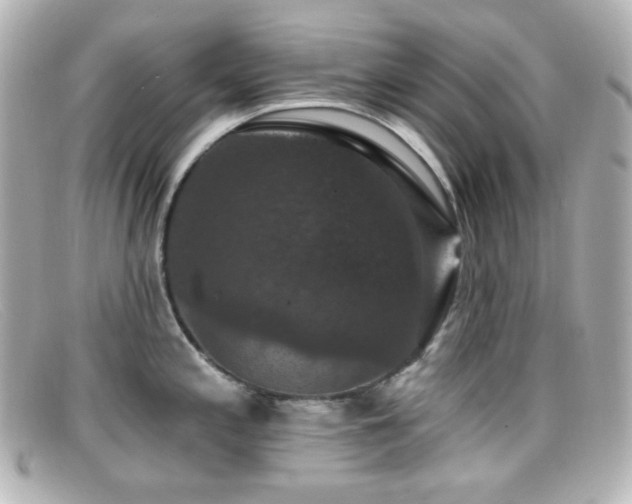 X0000099381197200805081439