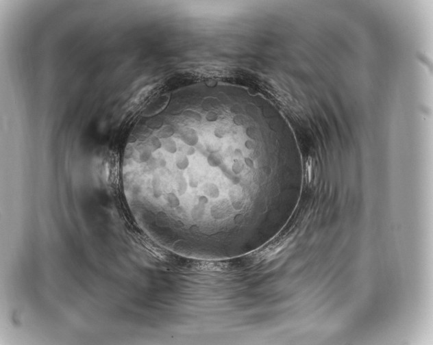 X0000099381251200805081438