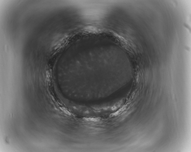 X0000099381397200805081435