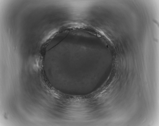 X0000099381399200805081435