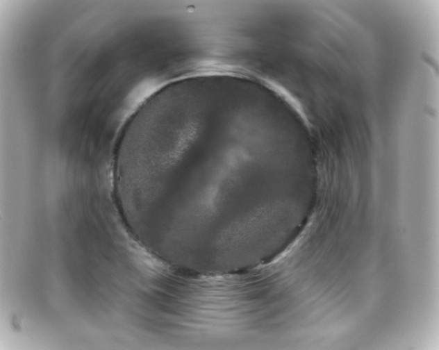 X0000099381415200805081435