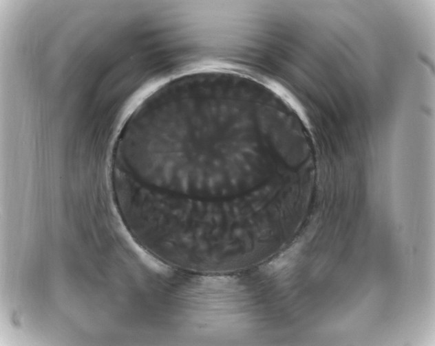 X0000099381429200805081436