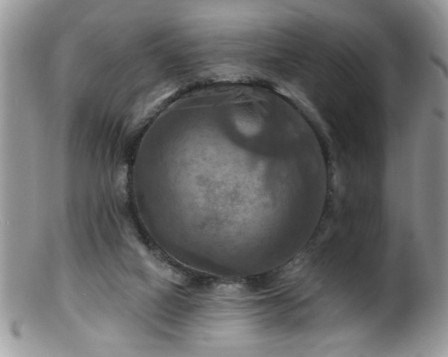 X0000099380066200805151628