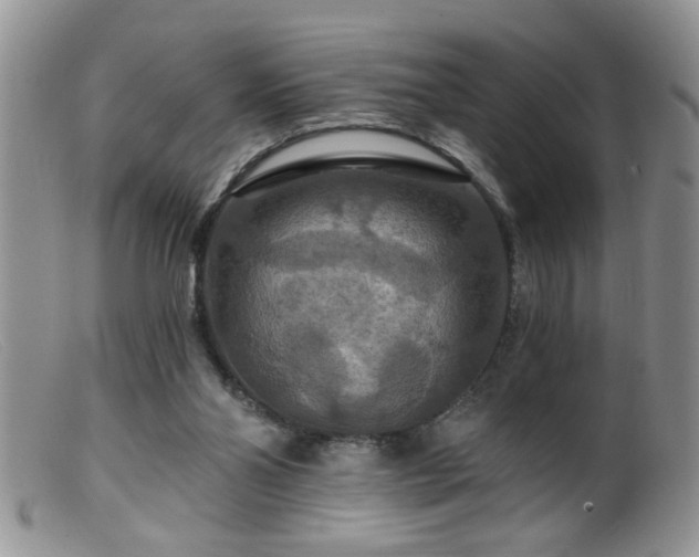 X0000099380110200805151628