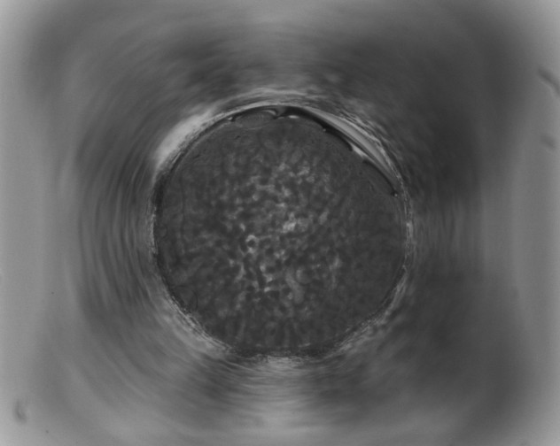 X0000099380149200805151627