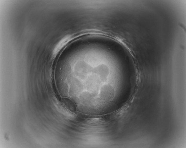 X0000099380151200805151627