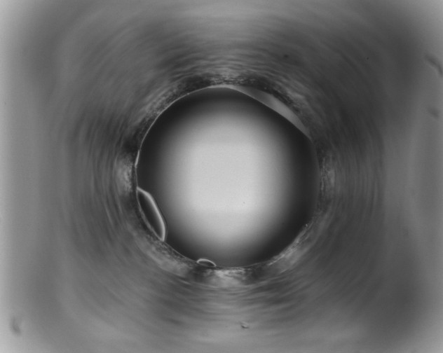 X0000099380188200805151627