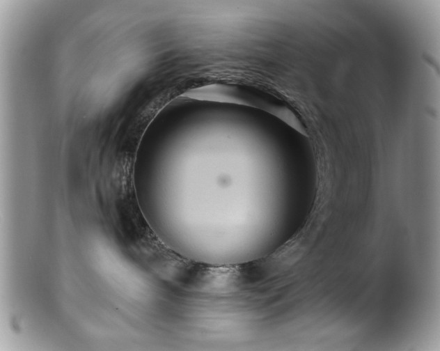 X0000099380240200805151626