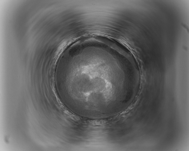 X0000099380241200805151625