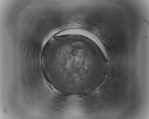 X0000099380244200805151625