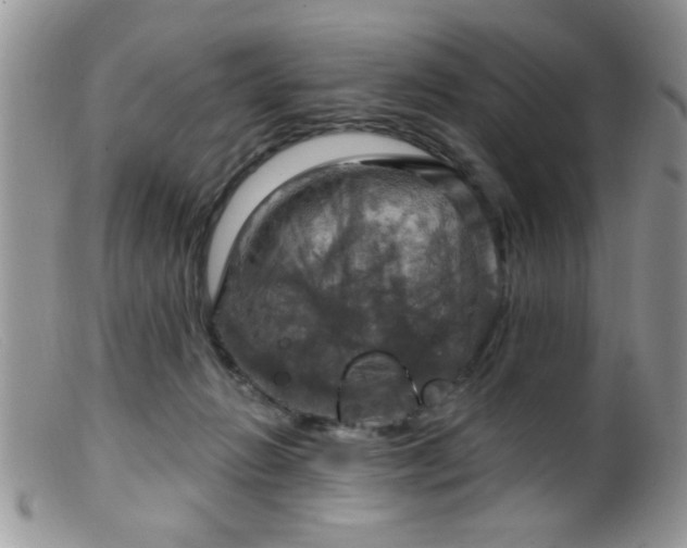 X0000099380270200805151625