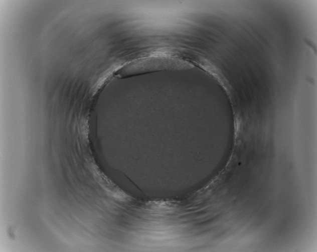 X0000099380297200805151625