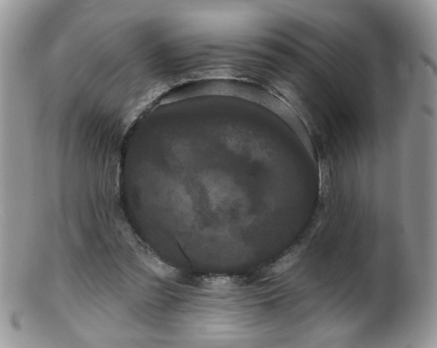 X0000099380301200805151625