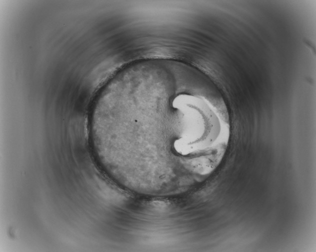 X0000099380302200805151625
