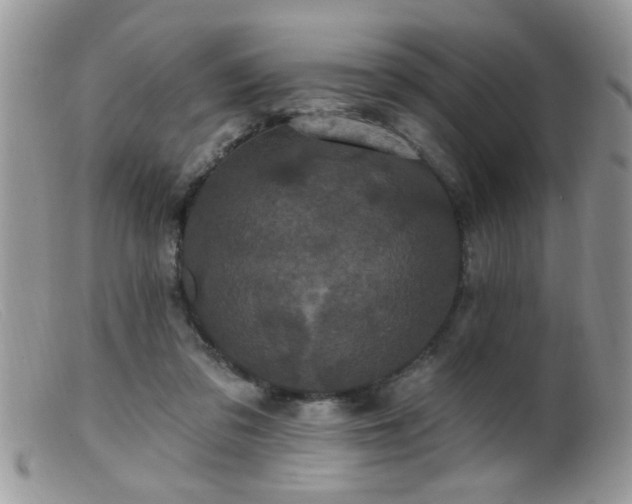 X0000099380309200805151625