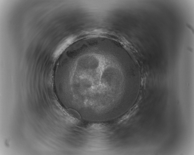 X0000099380341200805151624