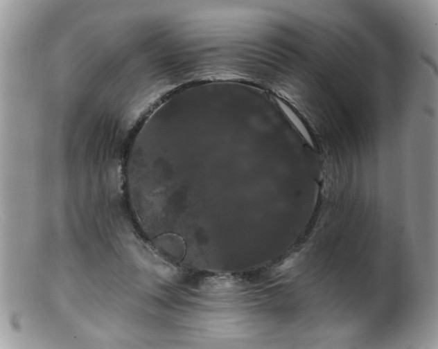 X0000099380351200805151624