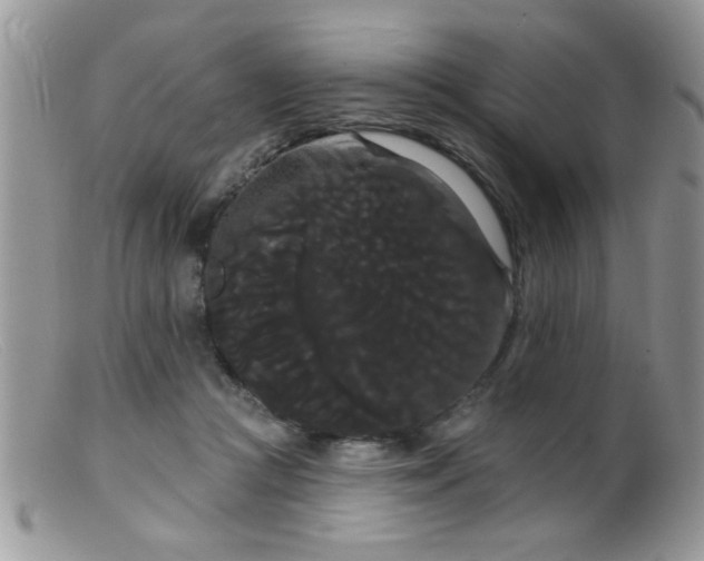 X0000099380361200805151624