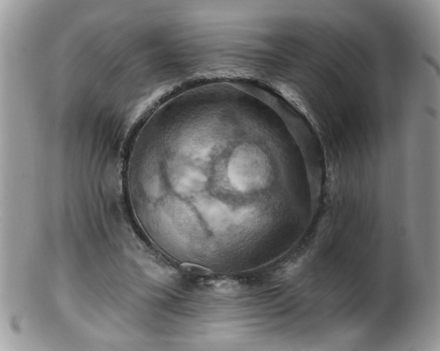 X0000099380395200805151623