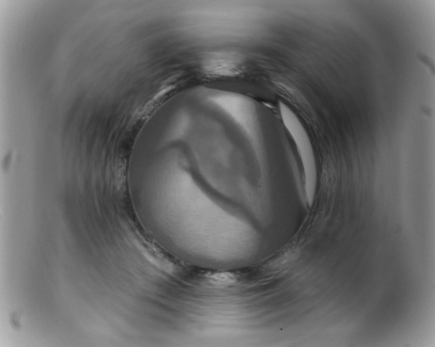 X0000099380409200805151623