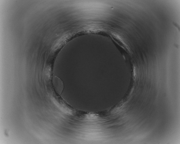 X0000099380451200805151622