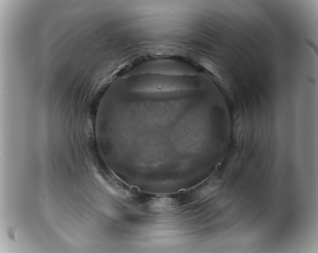 X0000099380459200805151622