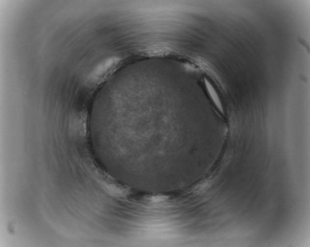 X0000099380501200805151622