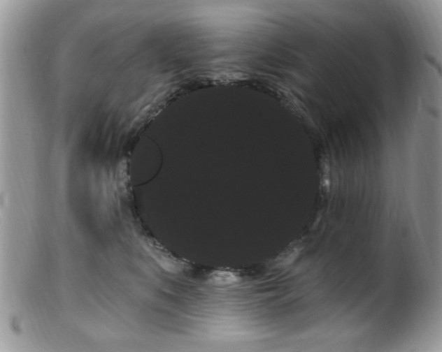 X0000099380519200805151621