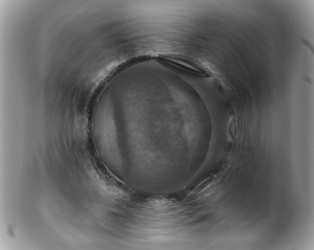 X0000099380540200805151621