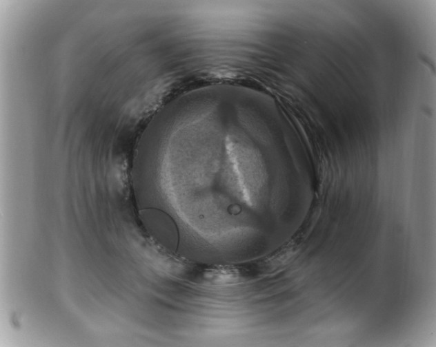 X0000099380559200805151621